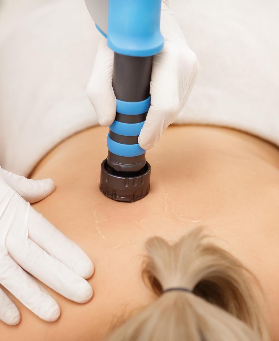 back-pain-shockwave-therapy-singapore